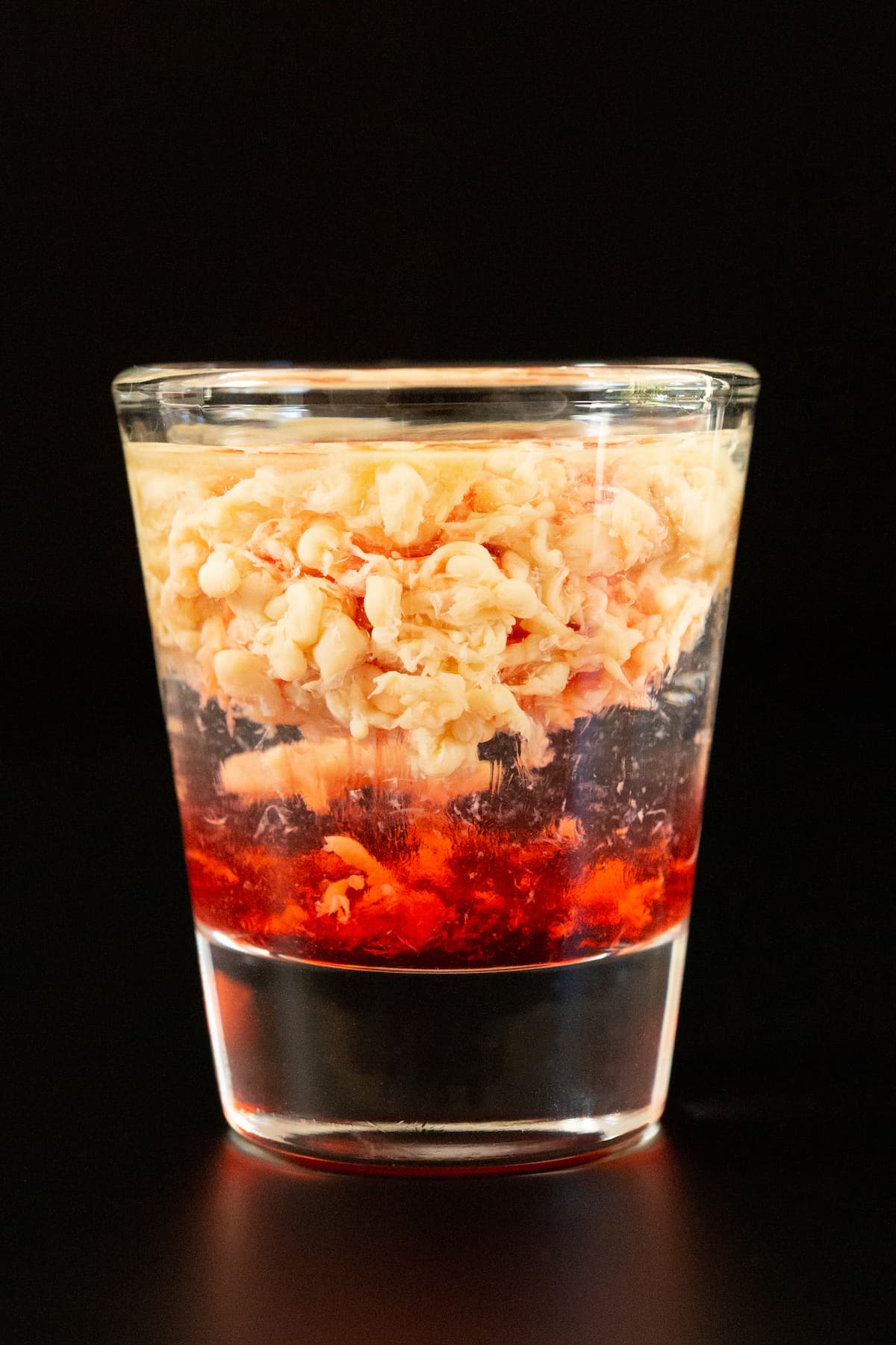 Brain Hemorrhage Shots